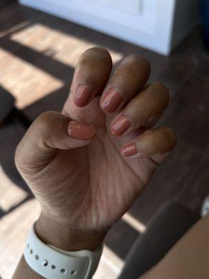 Q-NAILS