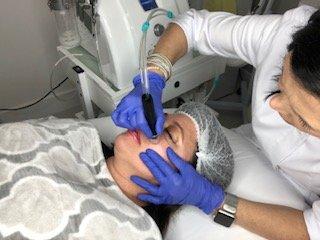 HydroFacial Treatment