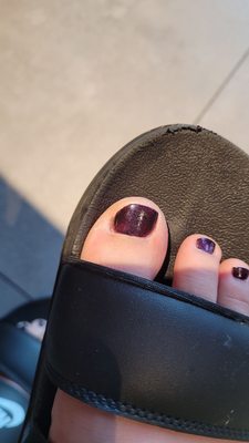 Toe nail is crooked