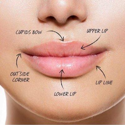 Juvederm Lip Enhancement Filler