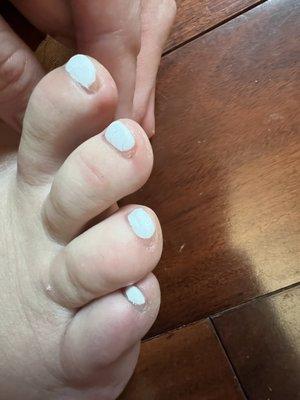 Again, toenails aren't even fully covered with gel