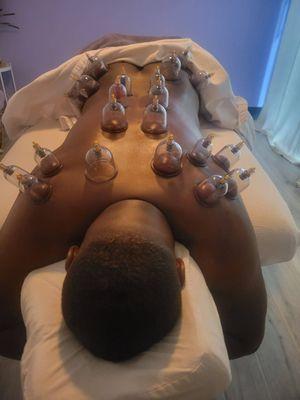 Cupping