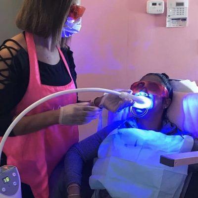 Teeth whitening