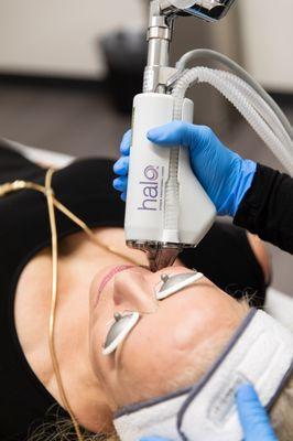 HALO Laser Treatments