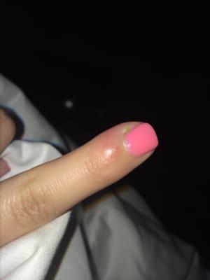 Worst manicure and pedicure experience and topped it off with a cuticle infection.