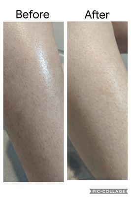 Before and after leg wax