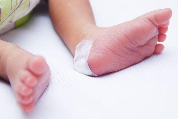 Taking a Heel Blood Sample From Newborn Baby