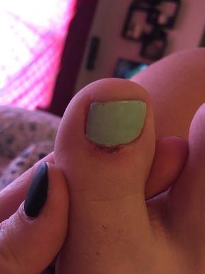 Got a pedicure at this place two days ago and clearly my cuticle was cut too far and now is inflamed. 0/5, would not recommend.