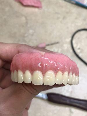 Denture with premium teeth