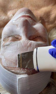 Oxygen infusion facial