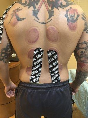 Cupping And tape work