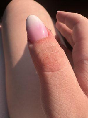 Filed some of my thumb skin off from filing in the wrong spots