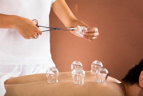 Cupping