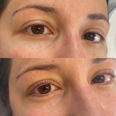 Lash lift