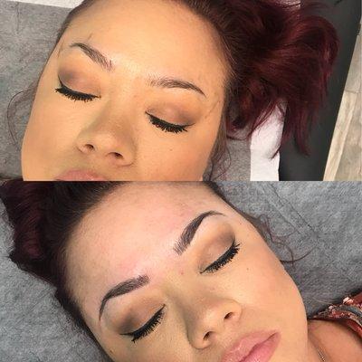 Microblading