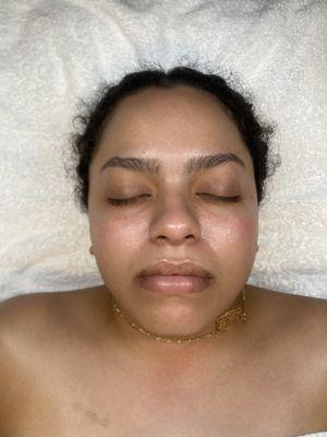 After Dry Facial