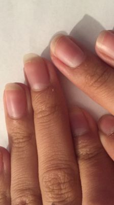 Nails are completely different lengths!