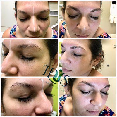 El microblading es la técnica perfecta Para cubrir esas feas cicatrices en tus cejitas...