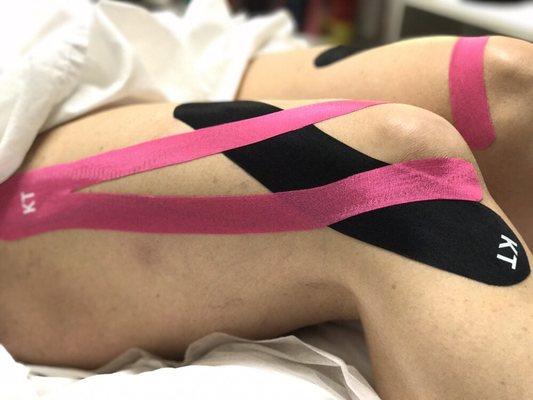 KT tape can be helpful for supporting joints without limiting the range of motion.  We find it very complimentary to acupuncture treatments.