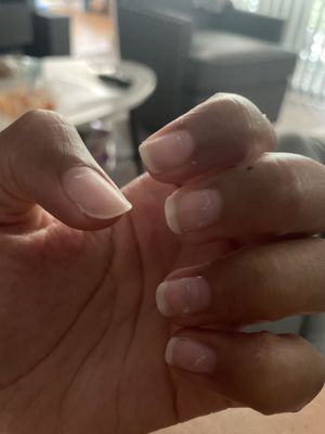 The result of them taking the acrylic nail crap off.