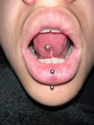 Under of tongue piercing