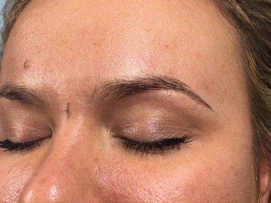 Left side before microblading