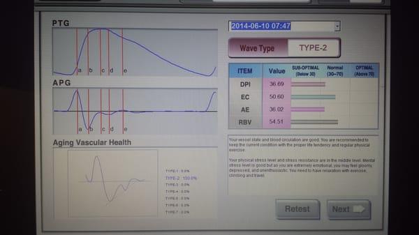 Heart Health Scanning