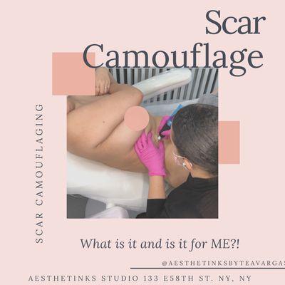 Scar Camouflaging in action. Book your consultation today!