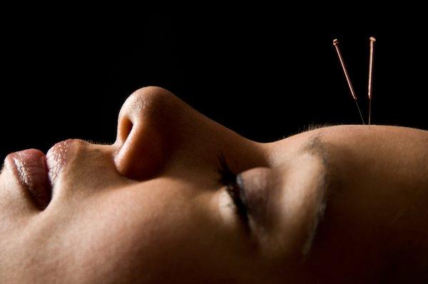 Acupuncture can help manage pain and resolve illnesses