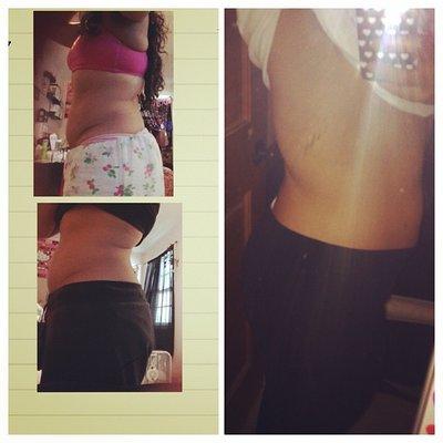 This was my first ever client Kim Cano. In literally 3 weeks, her belly fat, underarm fat and back fat were gone forever!