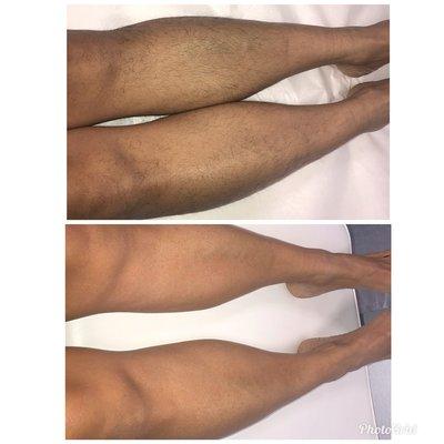 Lower Leg Waxing