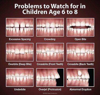 Early Intervention Orthodontic Tx