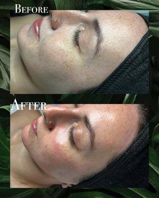 50 minute customized facial with dermaplane add-on.