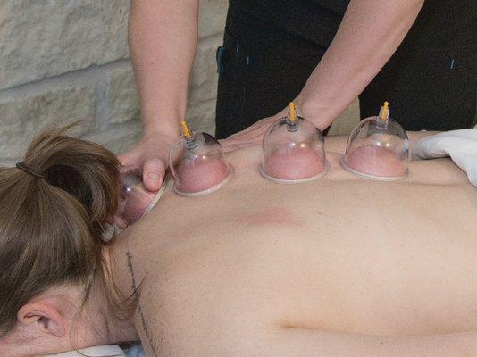 Massage cupping