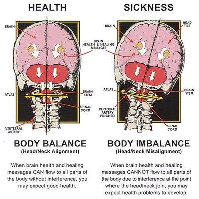 Cervical misalignment affects your whole body.