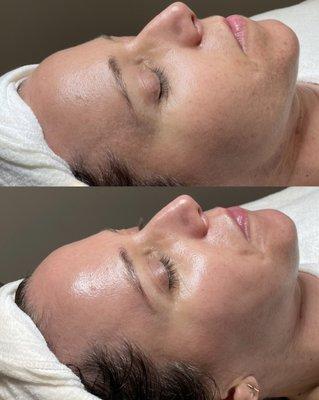 Boost collagen production and erase fine line with an Essential 60 Minute Facial + LED Therapy Upgrade.