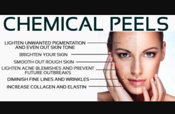 Chemical peels treat different skin conditions come in for your consultation today.