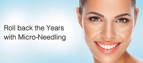 Microneedling