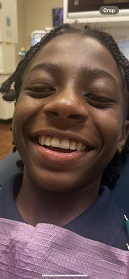 We received great service. He was very happy. The two front teeth were crowned.