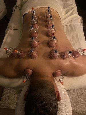 Cupping therapy