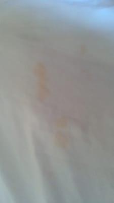 Nasty stains on sheets