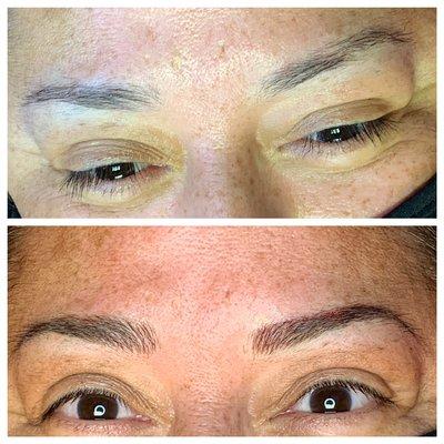 Before and after of a happy client