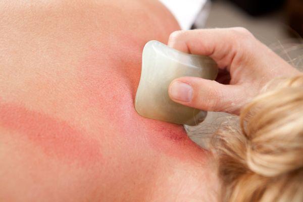 Gua sha, also called coining, spooning or scraping, removes blood stagnation. It is useful for acute & chronic conditions that affect organs