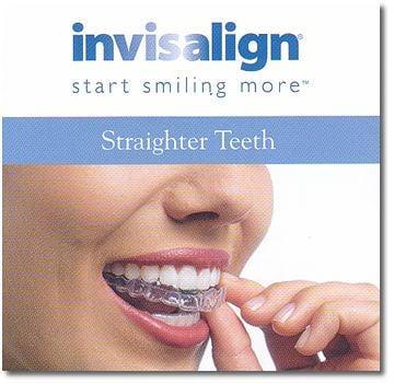 Invisalign- Clear Braces