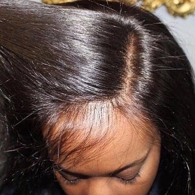 Frontals