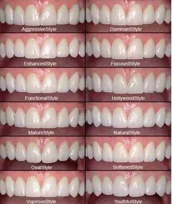 Custom Smile Designs