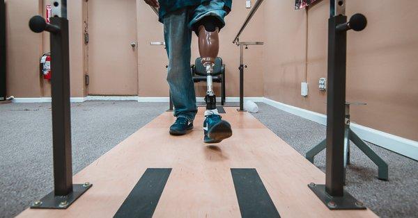 One of our patients testing out their new prosthetic