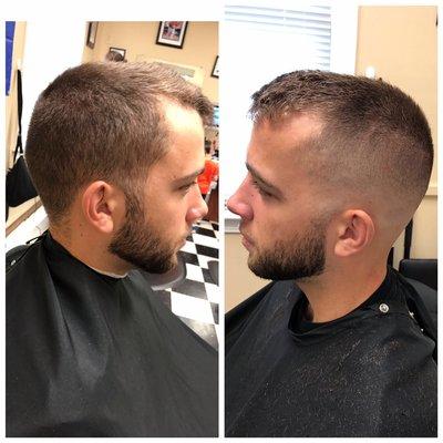 Bald fade and beard fade