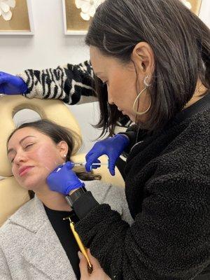 Deb, RN Injector is creating a jawline treatment with filler to create a beautiful and contoured look.