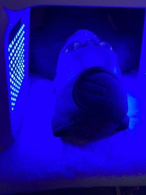 Using Blue LED light therapy to treat acne